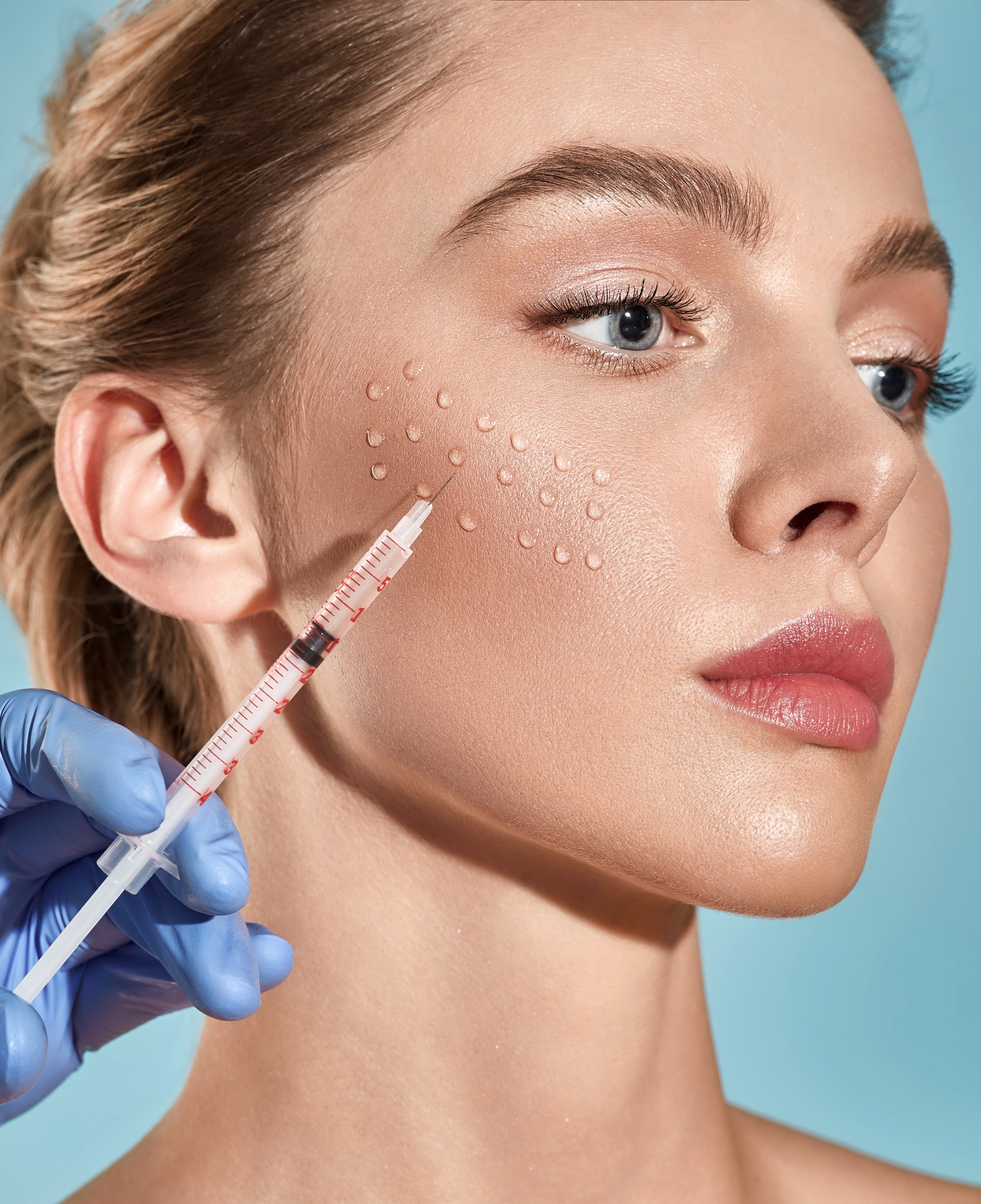 Biorevitalization. Beautiful woman getting beauty injections with hyaluronic acid for smoothing of
