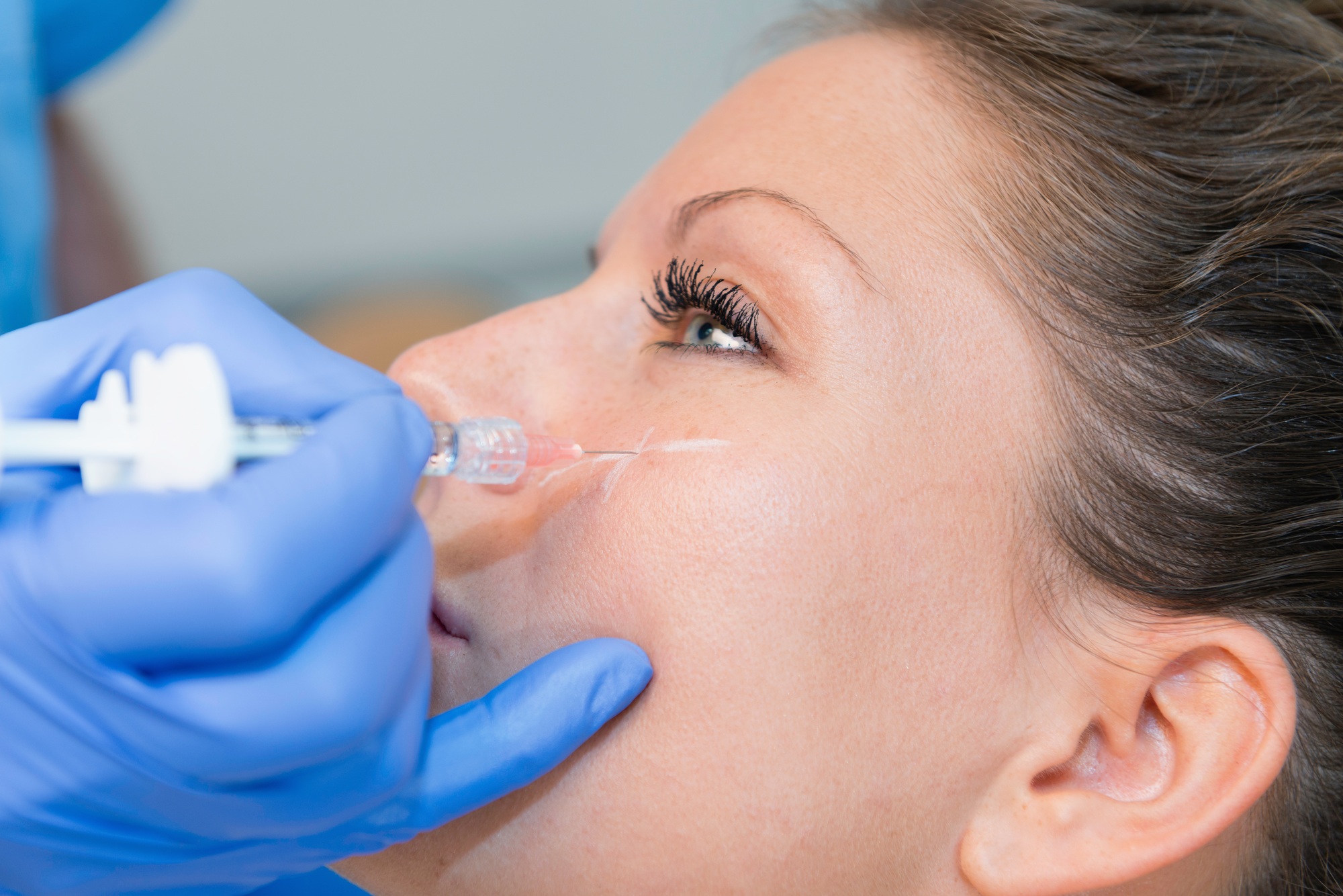 Hyaluronic acid